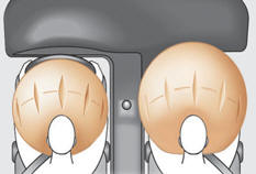 Airbags frontaux